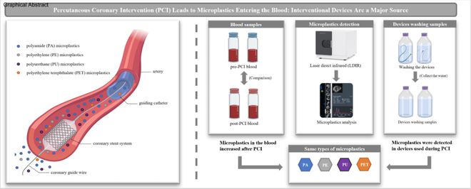 pg电子网站北京安贞医院张铭教授团队发现：经皮冠状动脉介入治疗导致大量微塑料进入血液